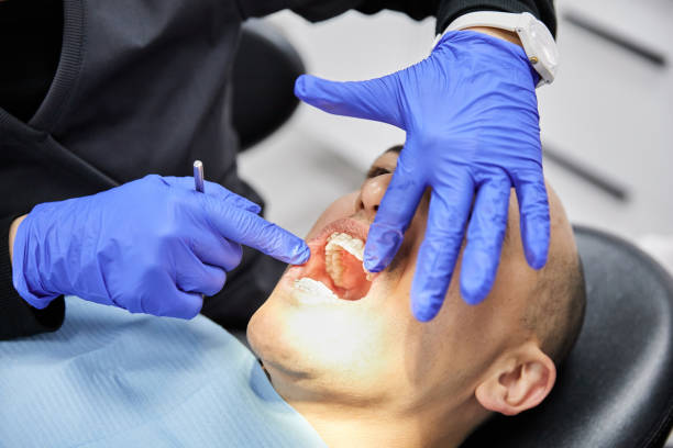Best Emergency Root Canal Therapy in Dunbar, WV